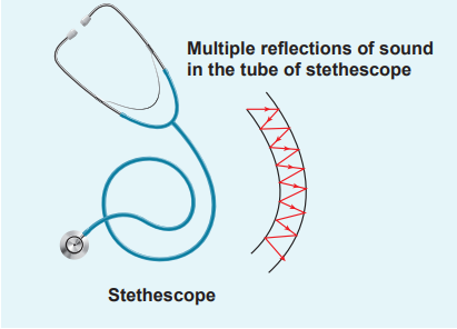 Figure 11.22 Stethoscope and multiple reflection of signal in a rubber tube