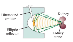 Fig. 5.65